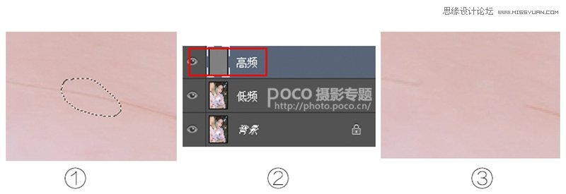 Photoshop巧用高低频工具去除人像面部的发丝